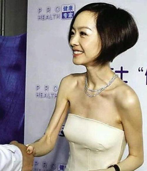 女明星减肥排行榜