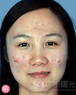 王痘痘的背景,从平凡少年到励志创业者的蜕变之路