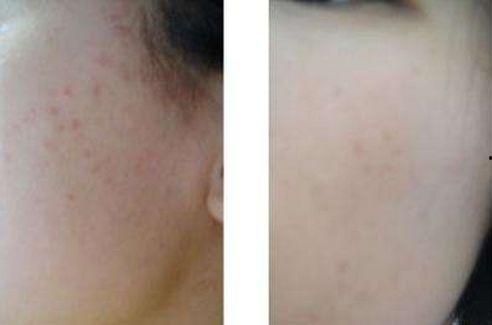 王痘痘的背景,从平凡少年到励志创业者的蜕变之路